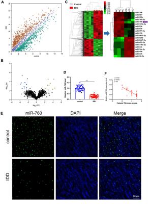 Downregulation of miR-760 Causes Human Intervertebral Disc Degeneration by Targeting the MyD88/Nuclear Factor-Kappa B Signaling Pathway